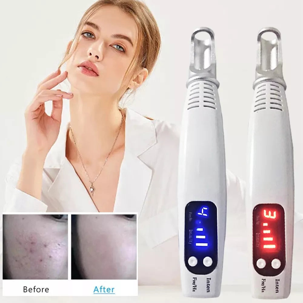 Tattoo & Blemish Removal Laser Pen – Safe & Effective Skin Care