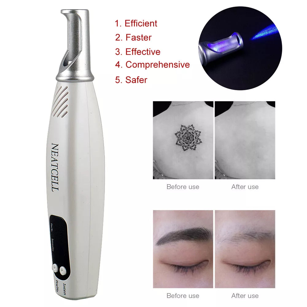 Tattoo & Blemish Removal Laser Pen – Safe & Effective Skin Care