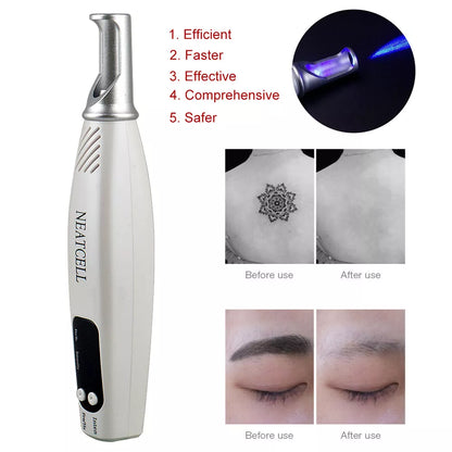 Tattoo & Blemish Removal Laser Pen – Safe & Effective Skin Care