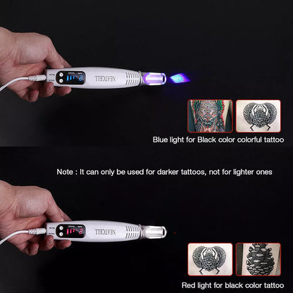 Tattoo & Blemish Removal Laser Pen – Safe & Effective Skin Care