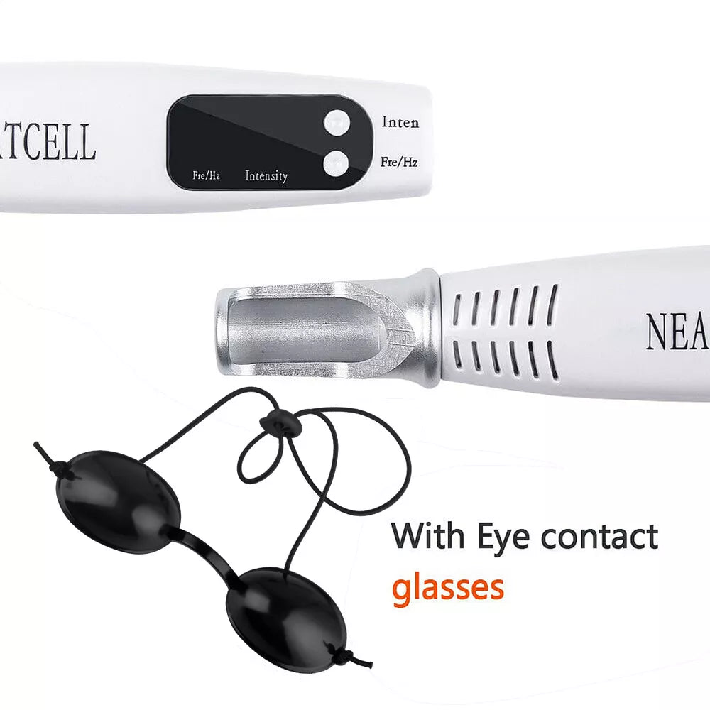 Tattoo & Blemish Removal Laser Pen – Safe & Effective Skin Care