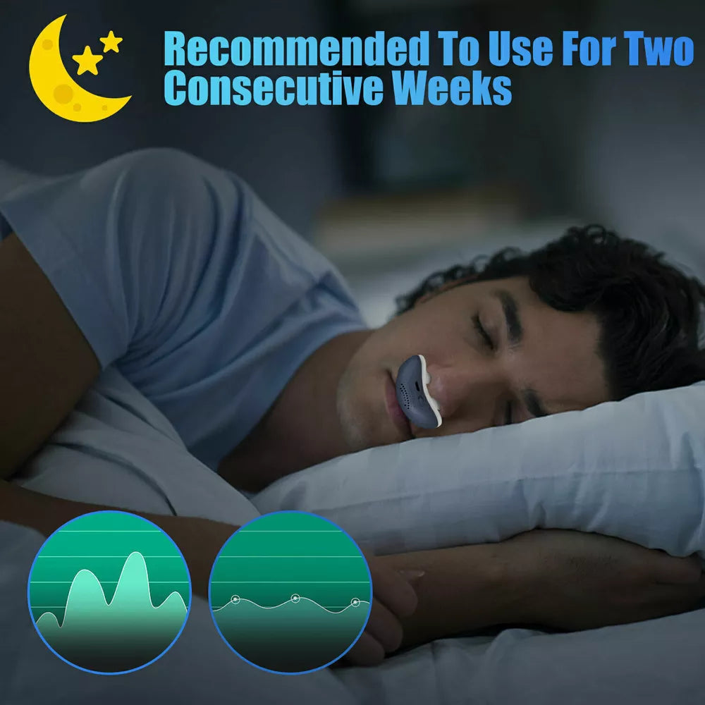 Anti-Snoring Device – USB Rechargeable & Comfortable Fit