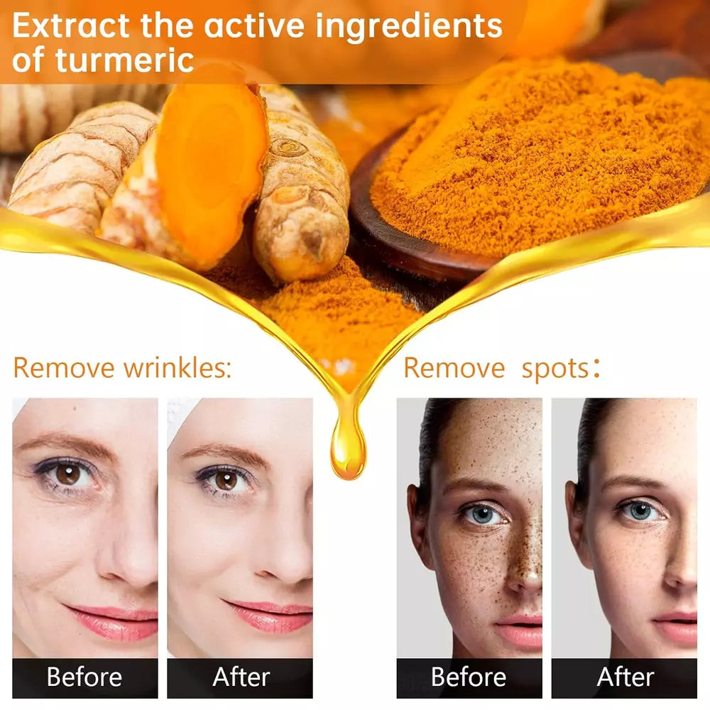 Turmeric Dark Spot Corrector Serum